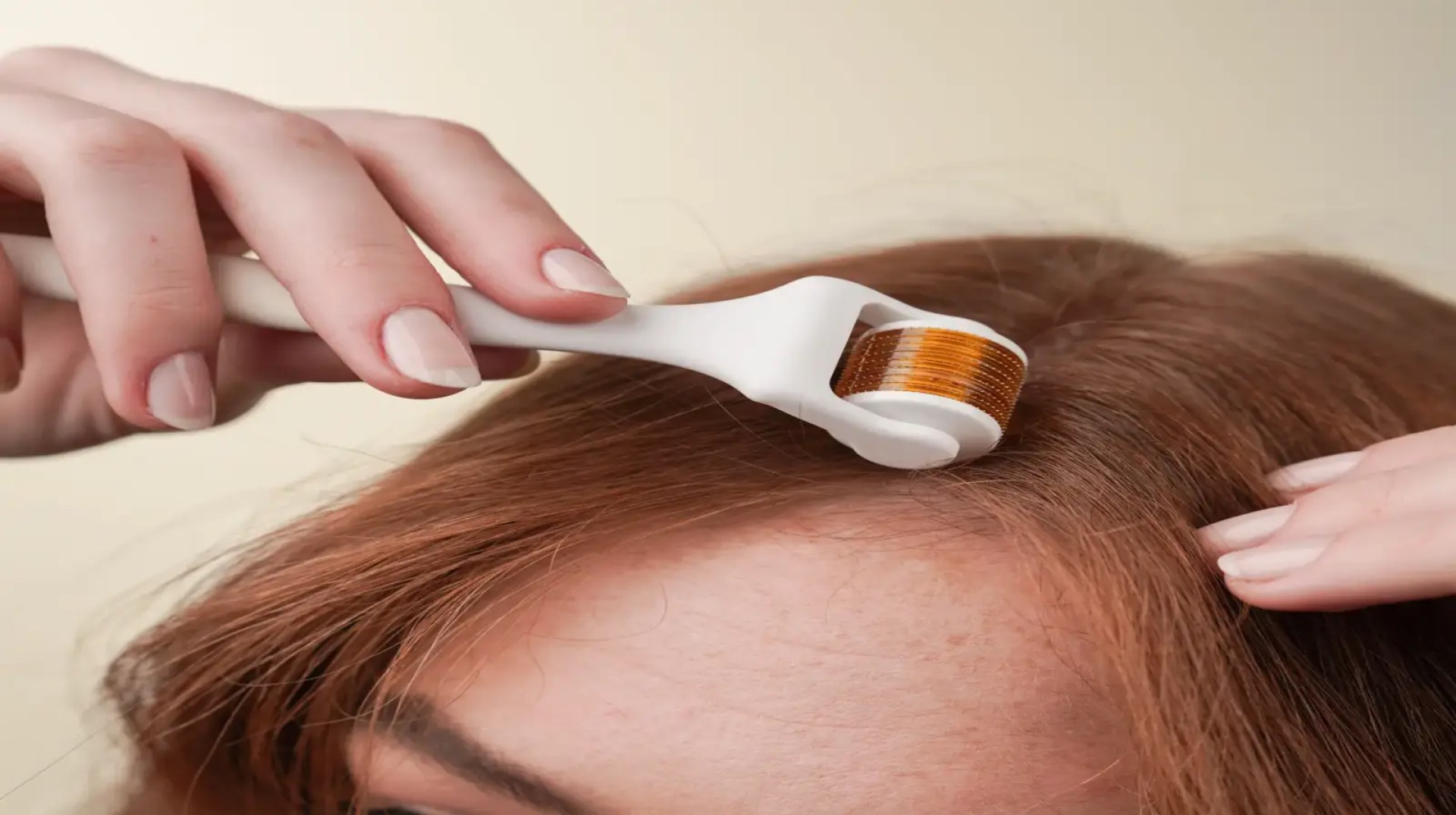 Thinking about a derma roller for hair growth? Here’s how to start Thinking about a derma roller for hair growth? Here’s how to start