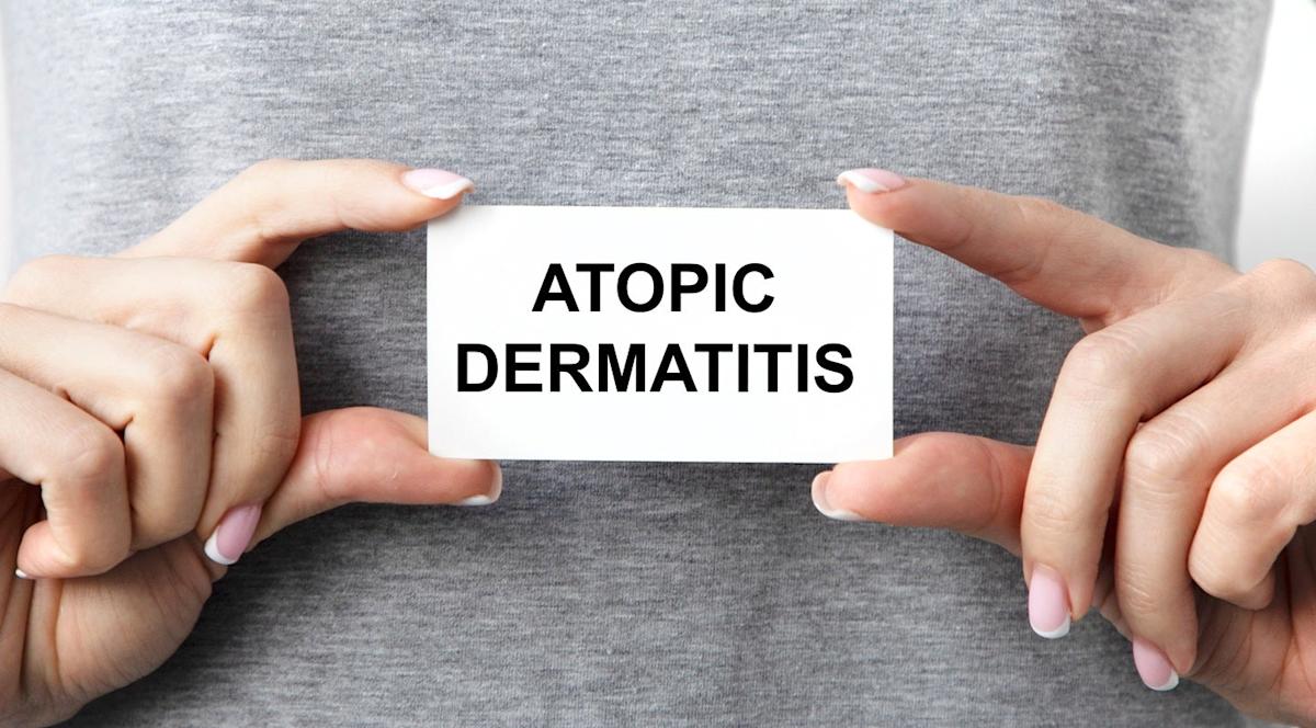 Regeneron and Sanofi’s dupilumab shows promise in AD trial Regeneron and Sanofi’s dupilumab shows promise in AD trial