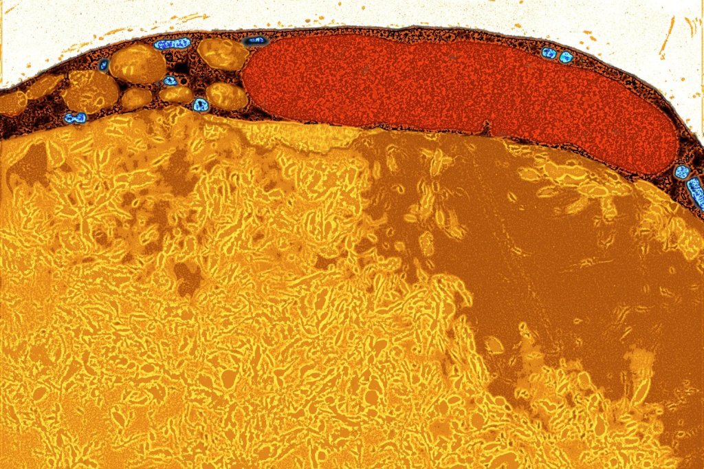Scientists Uncover an Unlikely New Weapon Against Cancer: Fat Cells Scientists Uncover an Unlikely New Weapon Against Cancer: Fat Cells