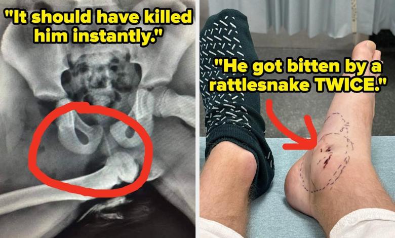 Doctors are revealing their craziest “You shouldn’t be alive” moment, and I’m surprised Doctors are revealing their craziest “You shouldn’t be alive” moment, and I’m surprised