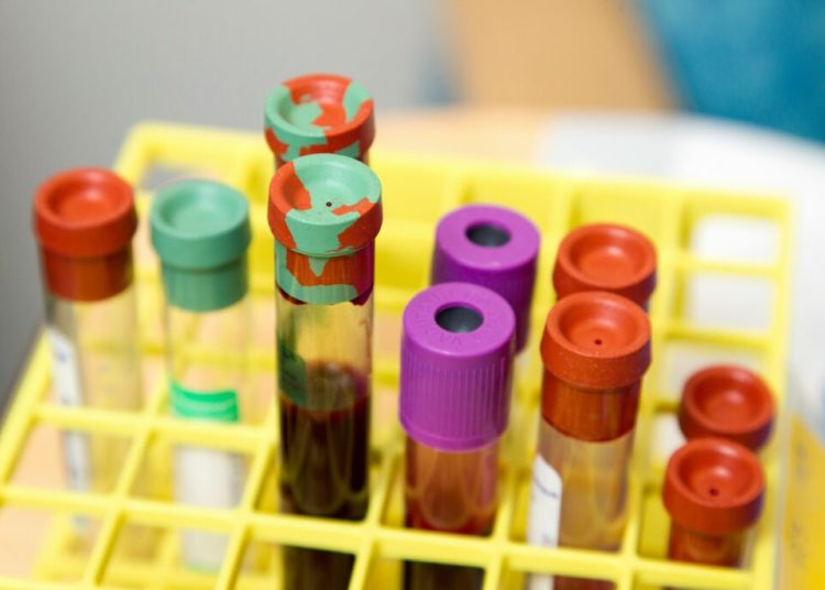 Tratamentul pentru slăbit care reduce semnificativ riscul de cancer de colon! Tratamentul pentru slăbit care reduce semnificativ riscul de cancer de colon!