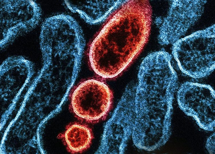 Virusul Nipah: Amenințarea unei noi epidemii care îngrijorează autoritățile Virusul Nipah: Amenințarea unei noi epidemii care îngrijorează autoritățile