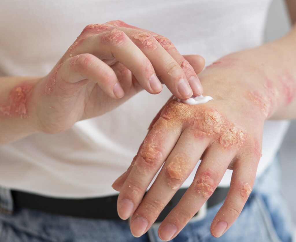 Iarna, pielea ta suferă: 5 sfaturi esențiale de la medici! Iarna, pielea ta suferă: 5 sfaturi esențiale de la medici!