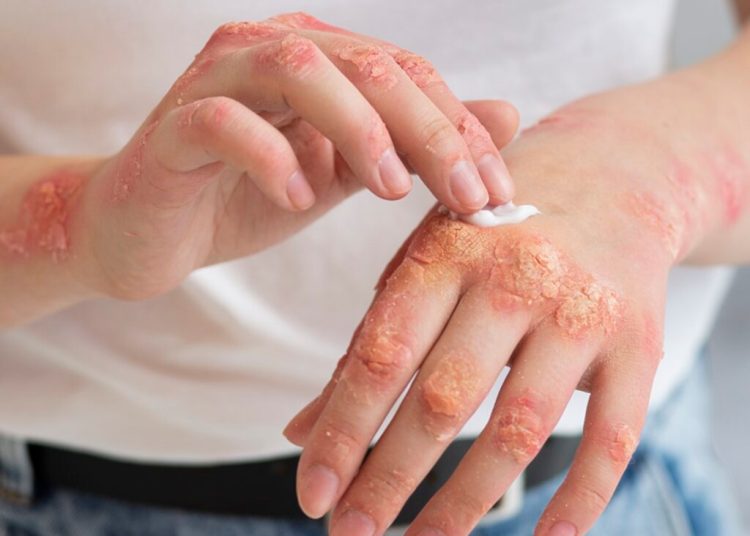 Iarna, pielea ta suferă: 5 sfaturi esențiale de la medici! Iarna, pielea ta suferă: 5 sfaturi esențiale de la medici!