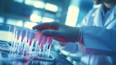 Maravai Lifesciences (MRVI) undergoes a redesign of leadership in the middle of the transition Maravai Lifesciences (MRVI) undergoes a redesign of leadership in the middle of the transition