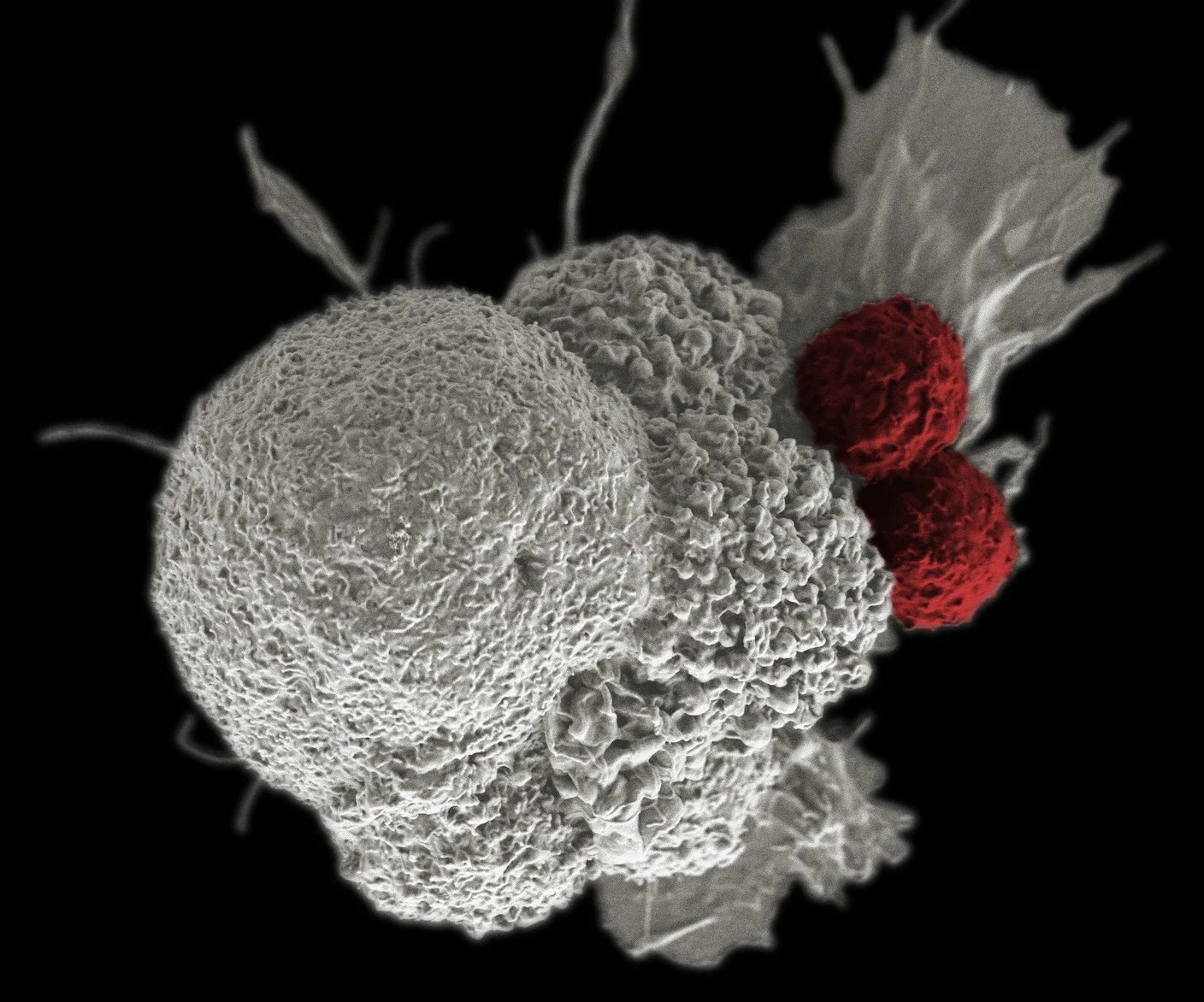 Scientists Say They’ve Discovered How Cancer Hijacks and Corrupts Immune Cells Scientists Say They’ve Discovered How Cancer Hijacks and Corrupts Immune Cells