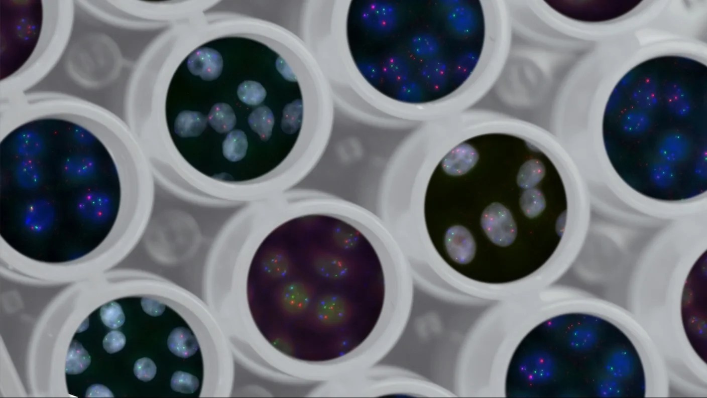 What Does Every Human Gene Do? This Massive Project Is About to Find Out What Does Every Human Gene Do? This Massive Project Is About to Find Out