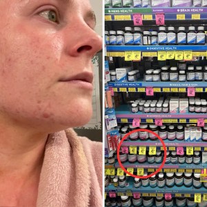 Discover the .50 Aussie Supermarket Find That Transformed Painful Acne—So Affordable, You Won’t Believe It! Discover the .50 Aussie Supermarket Find That Transformed Painful Acne—So Affordable, You Won’t Believe It!