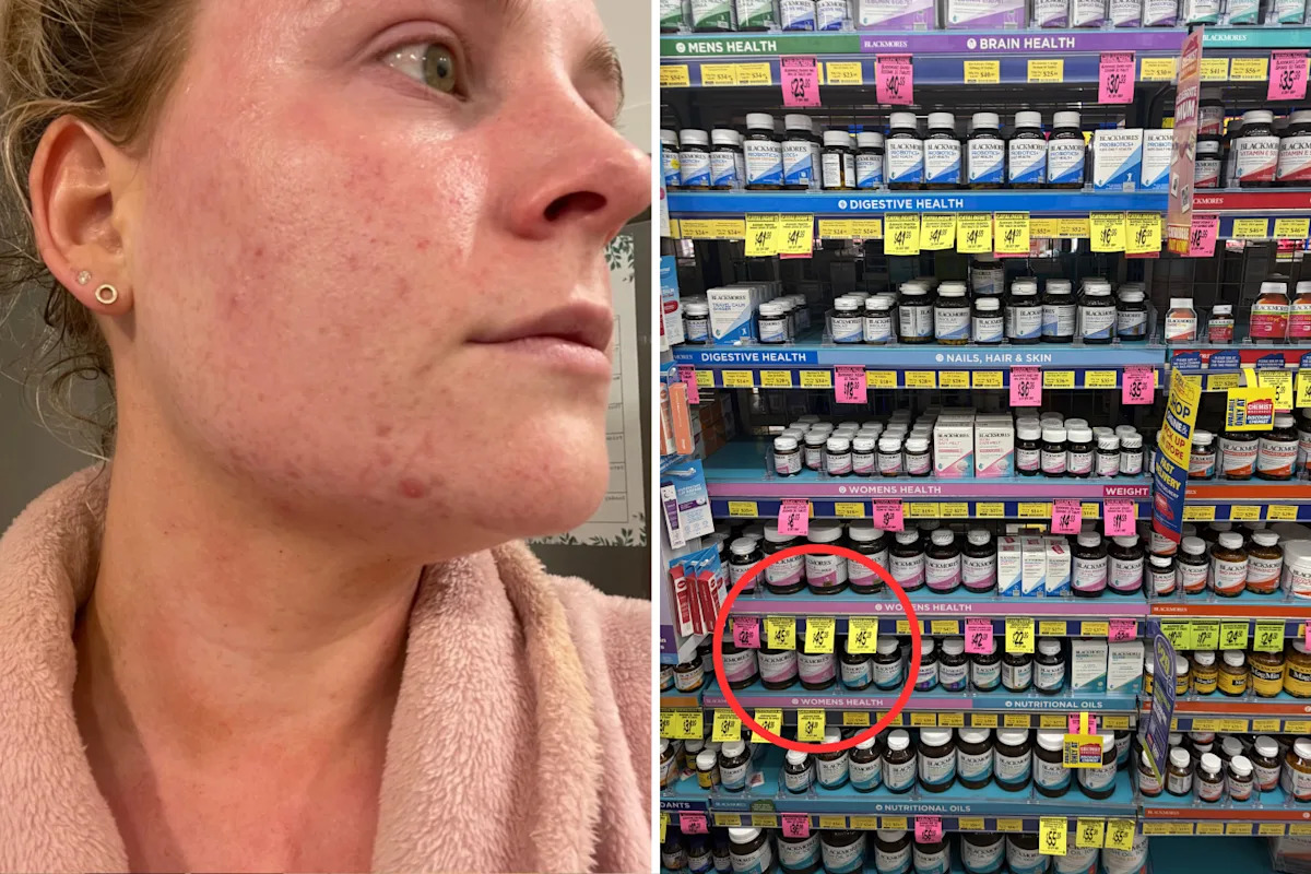 Discover the .50 Aussie Supermarket Find That Transformed Painful Acne—So Affordable, You Won’t Believe It! Discover the .50 Aussie Supermarket Find That Transformed Painful Acne—So Affordable, You Won’t Believe It!