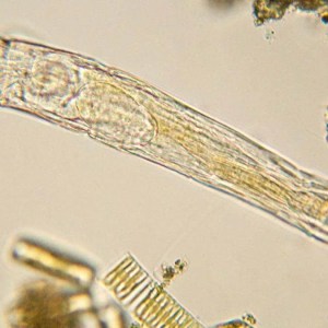 Groundbreaking Discovery: Scientists Resurrect 24,000-Year-Old ‘Zombie Worm’ from Arctic Ice and Witness Reproduction! Groundbreaking Discovery: Scientists Resurrect 24,000-Year-Old ‘Zombie Worm’ from Arctic Ice and Witness Reproduction!