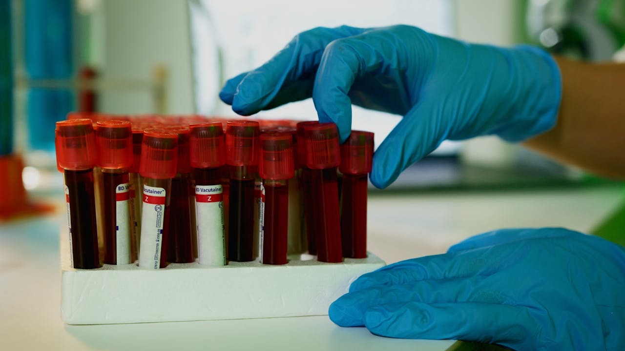 Grafic cu procentajul diagnosticelor HIV tardive în țările europene, evidențiind poziția României și importanța testării și prevenției HIV. | sursa foto: News.ro Grafic cu procentajul diagnosticelor HIV tardive în țările europene, evidențiind poziția României și importanța testării și prevenției HIV. | sursa foto: News.ro
