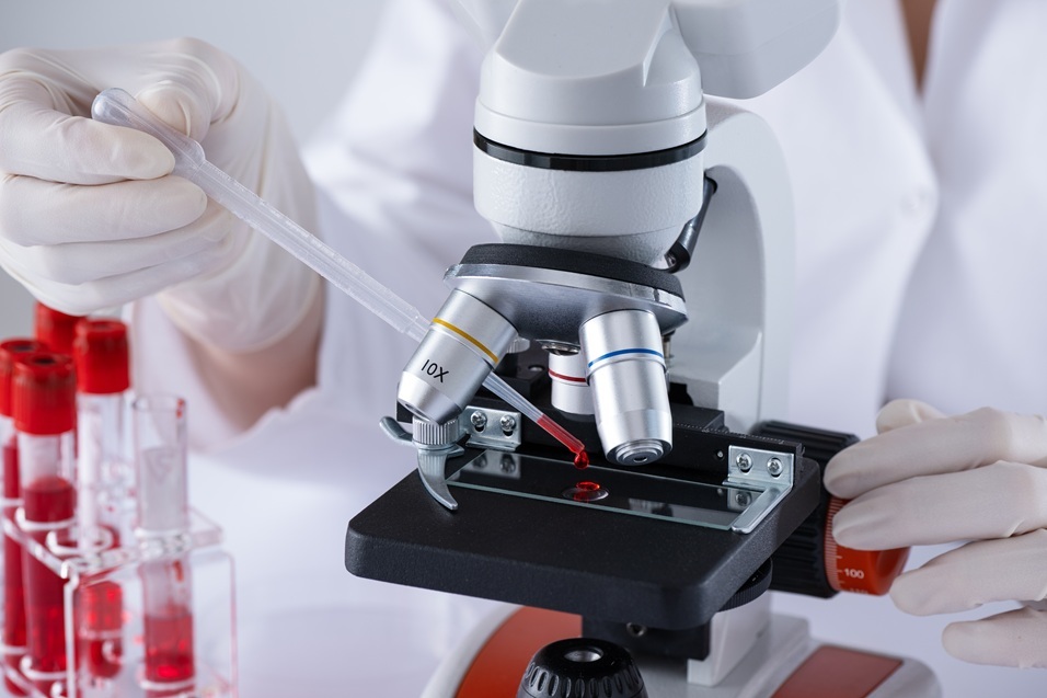 Model experimental cu țesut osos și pulmonar uman pentru studierea metastazelor cancer sân în țesut osos și țesut pulmonar. | sursa foto: News.ro Model experimental cu țesut osos și pulmonar uman pentru studierea metastazelor cancer sân în țesut osos și țesut pulmonar. | sursa foto: News.ro