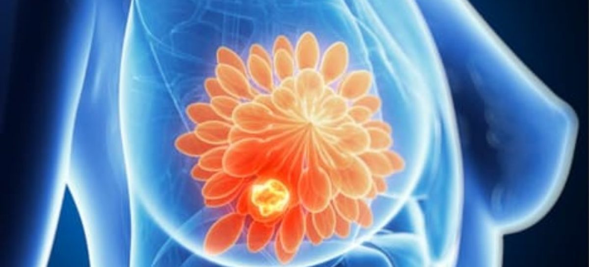 Grafic cu evoluția numărului de cazuri de cancer UE și creșterea cheltuielilor oncologie în statele membre, evidențiind programe screening cancer. | sursa foto: News.ro Grafic cu evoluția numărului de cazuri de cancer UE și creșterea cheltuielilor oncologie în statele membre, evidențiind programe screening cancer. | sursa foto: News.ro