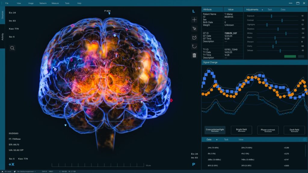 Diagramă schematică a neuronilor somn din trunchiul encefalic care reglează nevoia de somn și tulburările somn la șoareci în studiu experimental | sursa foto: Descopera Diagramă schematică a neuronilor somn din trunchiul encefalic care reglează nevoia de somn și tulburările somn la șoareci în studiu experimental | sursa foto: Descopera