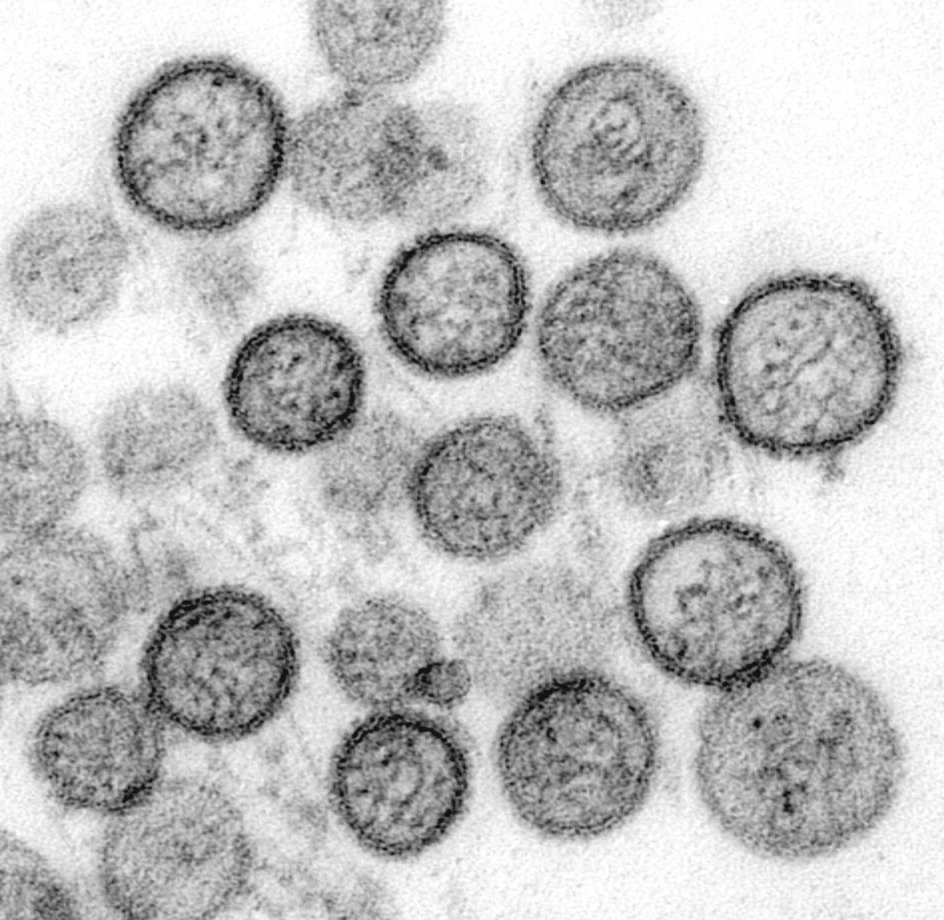 Echipa de experți discută măsuri sănătate publică pentru controlul hantavirus focar și prevenirea transmitere hantavirus în contextul unui focar recent. | sursa foto: Profit Echipa de experți discută măsuri sănătate publică pentru controlul hantavirus focar și prevenirea transmitere hantavirus în contextul unui focar recent. | sursa foto: Profit