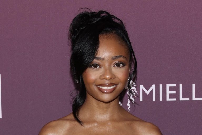 Skai Jackson Seeks Advice As She Opens Up About Her Postpartum Hair Loss Journey (VIDEO) Skai Jackson Seeks Advice As She Opens Up About Her Postpartum Hair Loss Journey (VIDEO)
