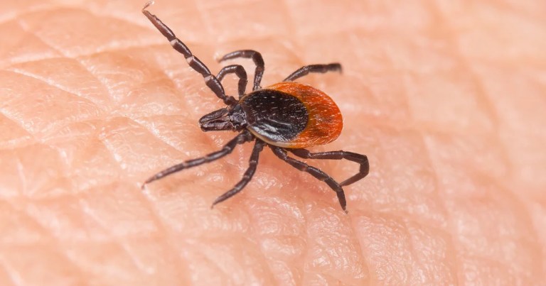 Tick bites are sending more people to the ER this summer. An expert explains why. Tick bites are sending more people to the ER this summer. An expert explains why.
