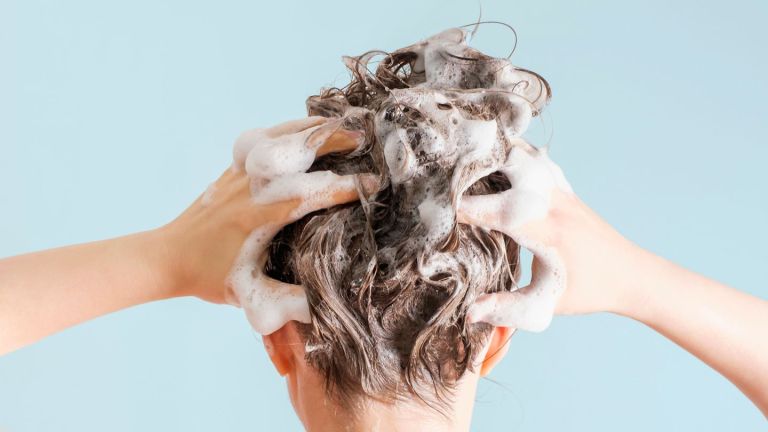 Caring for Your Hair and Scalp When You Have Alopecia Areata Caring for Your Hair and Scalp When You Have Alopecia Areata