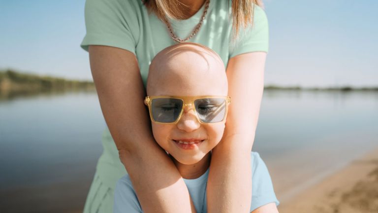 Alopecia in Children Alopecia in Children
