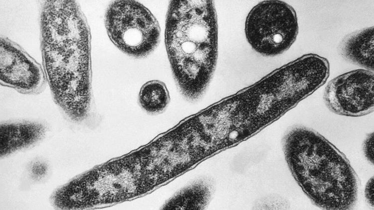 5th person dies after a Legionnaires’ disease outbreak sickens dozens in New York City 5th person dies after a Legionnaires’ disease outbreak sickens dozens in New York City
