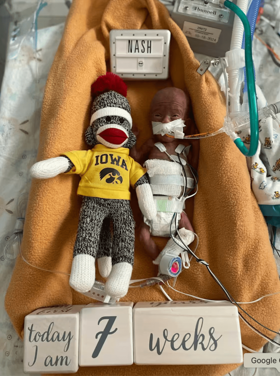 Baby boy born at 21 weeks has set Guinness Record for prematurity Baby boy born at 21 weeks has set Guinness Record for prematurity