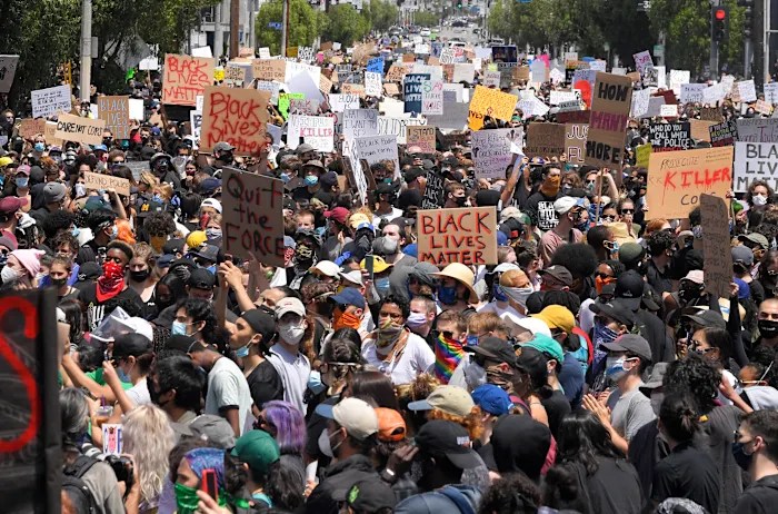 Jury awards more than million to protester shot in face with nonlethal projectile Jury awards more than million to protester shot in face with nonlethal projectile