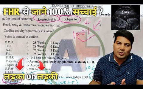 ultrasound bache ki dhadkan / transverse baby position / oblique lie position of baby / longitudinal ultrasound bache ki dhadkan / transverse baby position / oblique lie position of baby / longitudinal