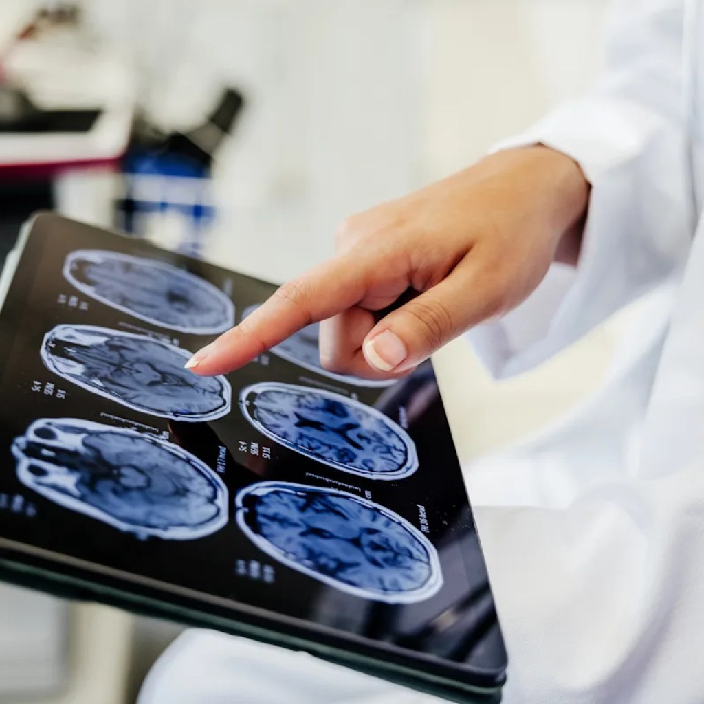 À 30 ans, elle attribue ses problèmes de vue à la pression de l’avion, c’était le premier signe d’une tumeur cérébrale À 30 ans, elle attribue ses problèmes de vue à la pression de l’avion, c’était le premier signe d’une tumeur cérébrale