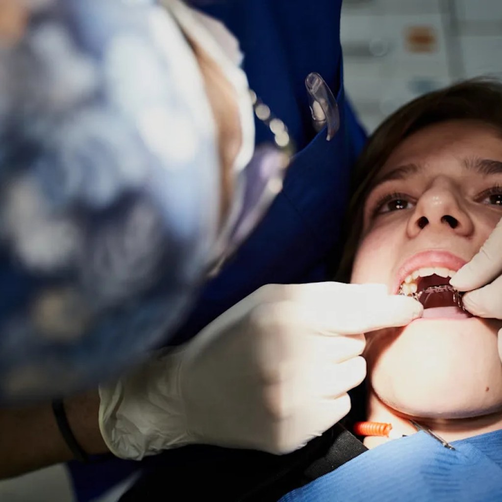 Bagues, gouttières, chirurgie… Comment aligner ses dents ? Bagues, gouttières, chirurgie… Comment aligner ses dents ?