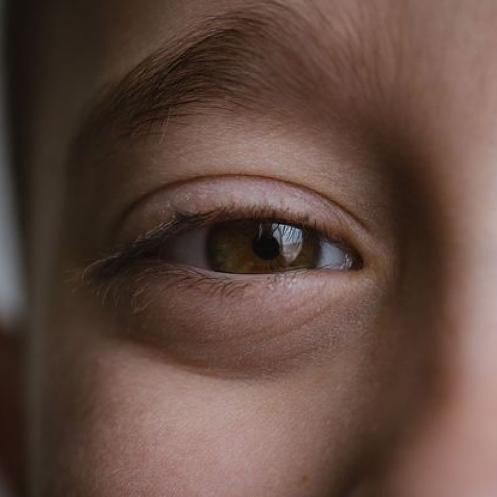 Bixonimanie : Cette maladie qui n’existe pas a trompé l’IA mais aussi plusieurs scientifiques Bixonimanie : Cette maladie qui n’existe pas a trompé l’IA mais aussi plusieurs scientifiques