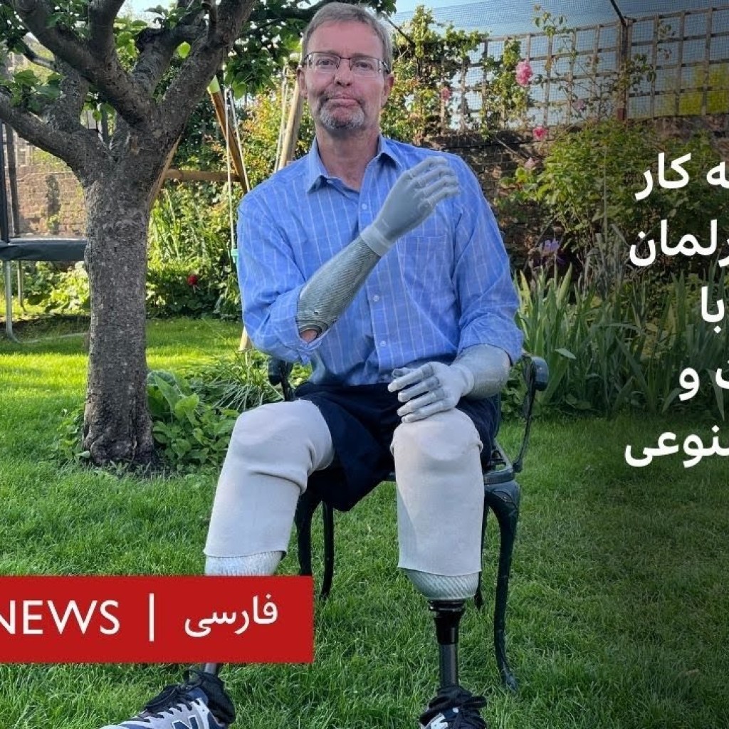 بازگشت به کار نماینده پارلمان بریتانیا با دو دست و دو پای مصنوعی بازگشت به کار نماینده پارلمان بریتانیا با دو دست و دو پای مصنوعی