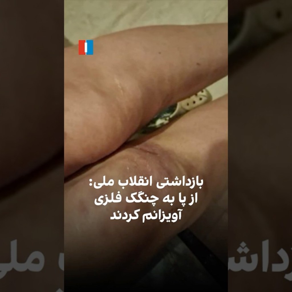 بازداشتی انقلاب ملی: از پا به چنگک فلزی آویزانم کردند بازداشتی انقلاب ملی: از پا به چنگک فلزی آویزانم کردند