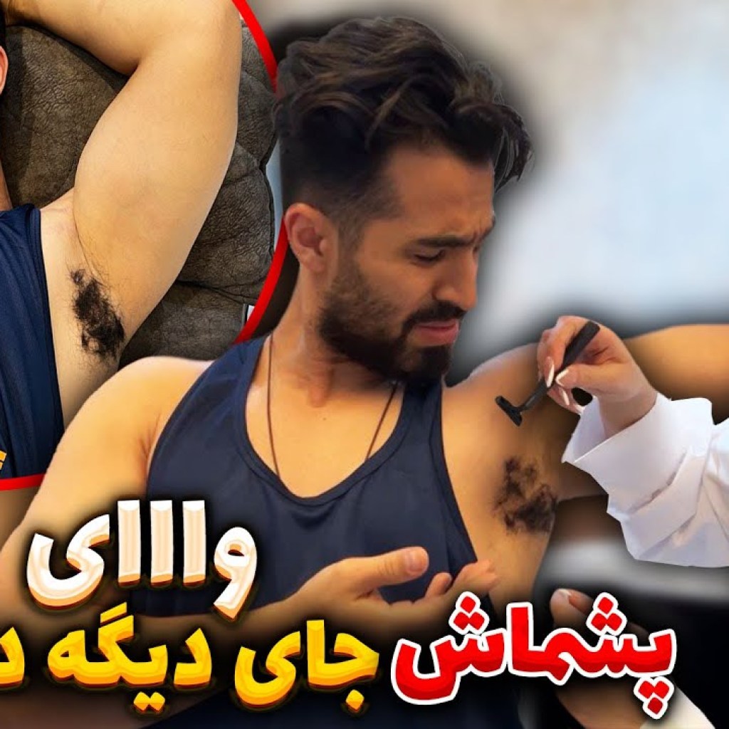 وای پشماش جای دیگه در اومده وای پشماش جای دیگه در اومده