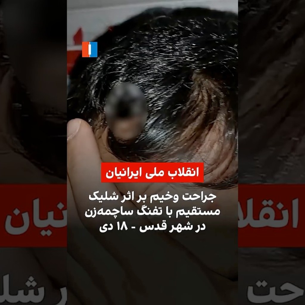 جراحت وخیم بر اثر شلیک مستقیم با تفنگ ساچمهزن در شهر قدس – ۱۸ دی جراحت وخیم بر اثر شلیک مستقیم با تفنگ ساچمهزن در شهر قدس – ۱۸ دی