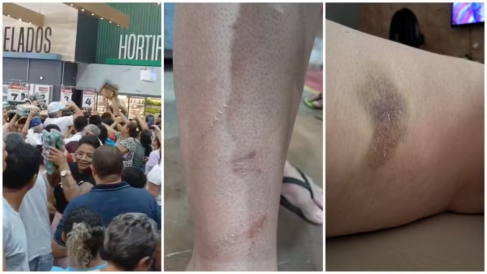 Tumulto durante promoção de ovo deixa feridos em supermercado em Fortaleza Tumulto durante promoção de ovo deixa feridos em supermercado em Fortaleza