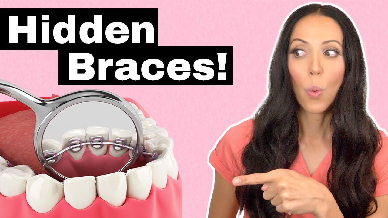Can You Have a Tongue Ring with Braces? Can You Have a Tongue Ring with Braces?