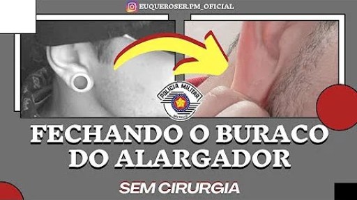 O que fazer para o furo da orelha não fechar? O que fazer para o furo da orelha não fechar?