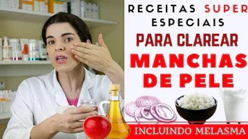 Como acabar com pintas pretas na pele? Como acabar com pintas pretas na pele?