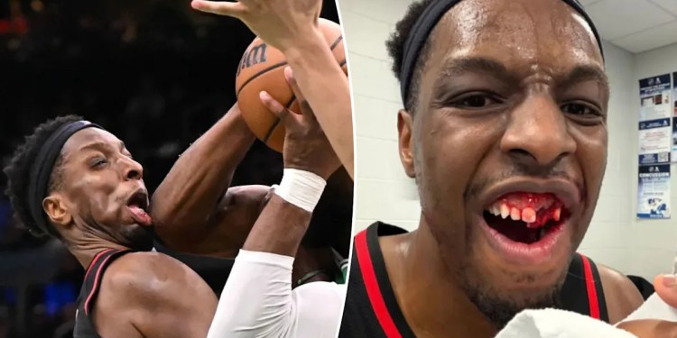 Onyeka Okongwu Sustains Injury from Elbow to Face Onyeka Okongwu Sustains Injury from Elbow to Face