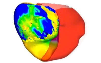 To fix a patient's irregular heartbeat, doctors first tested its digital 'twin' To fix a patient's irregular heartbeat, doctors first tested its digital 'twin'