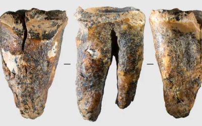 59,000-year-old tooth offers a rare glimpse into how Neanderthals handled a medical problem 59,000-year-old tooth offers a rare glimpse into how Neanderthals handled a medical problem