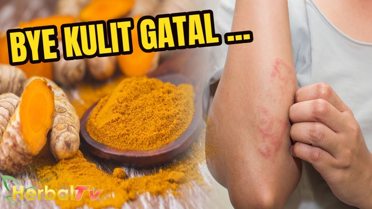 Cara Mengatasi Gatal-Gatal Pada Kulit Kering Cara Mengatasi Gatal-Gatal Pada Kulit Kering