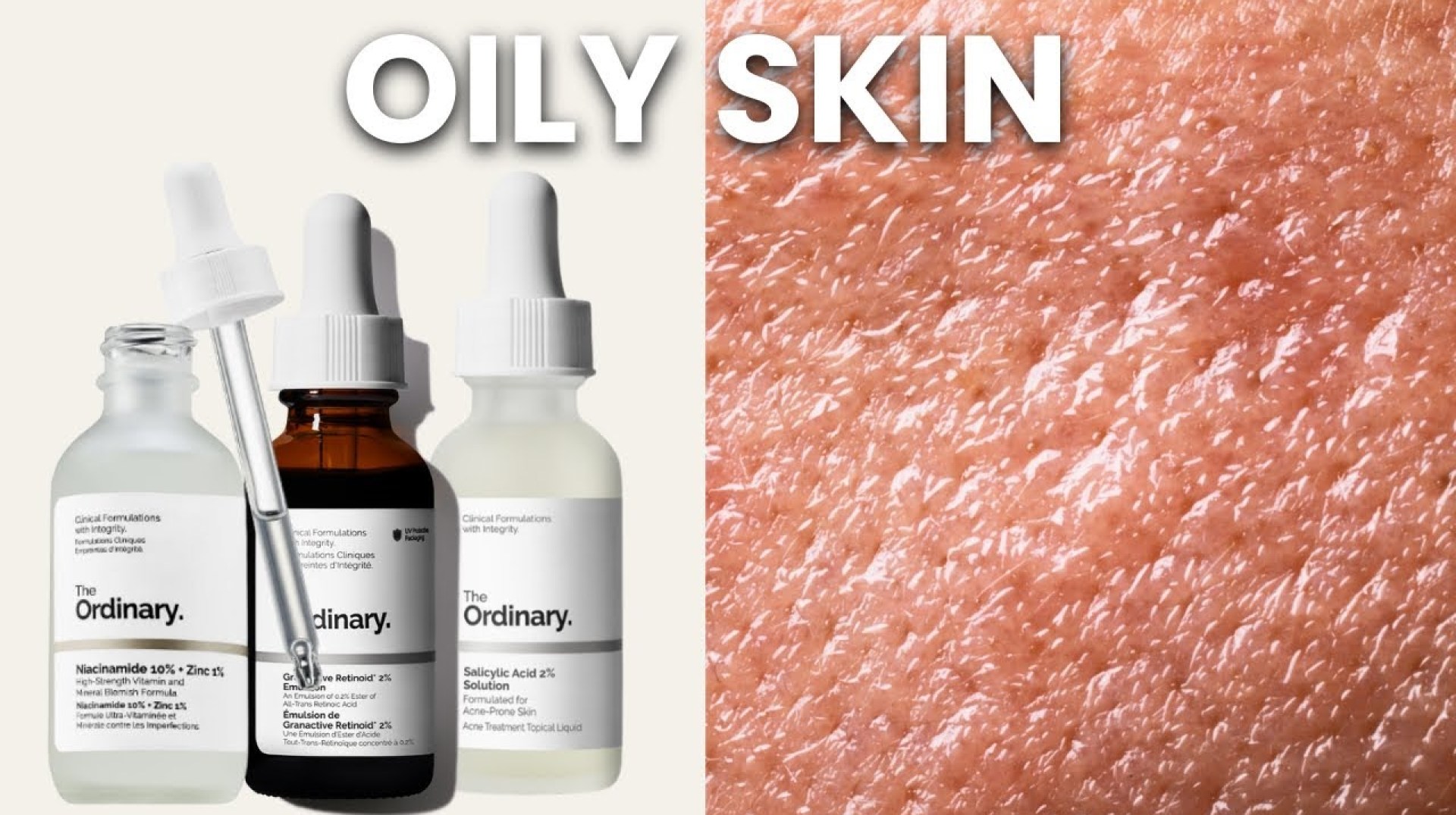 Top 5 Ordinary Skincare for Oily Skin + How To Layer Them Top 5 Ordinary Skincare for Oily Skin + How To Layer Them
