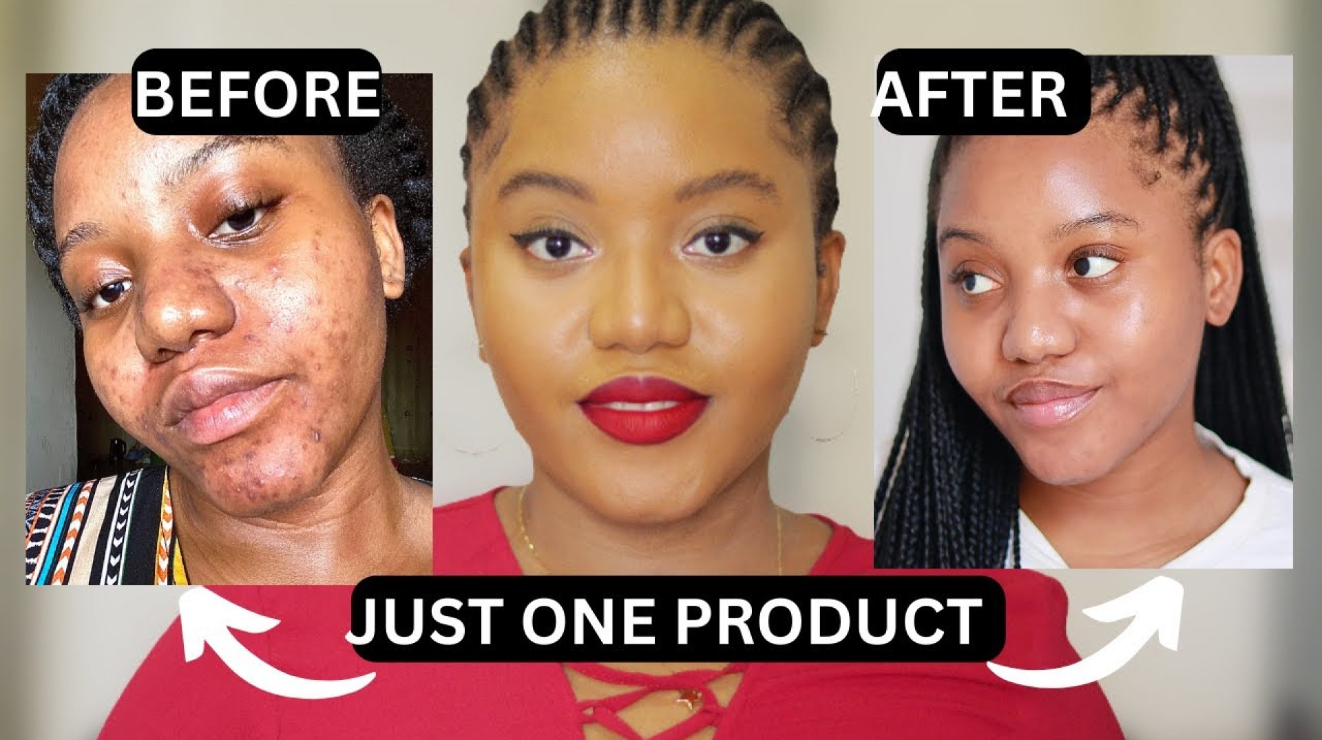HOW TO GET RID OF DARK SPOTS WITH ONE PRODUCT | SERUM THAT WORKS HOW TO GET RID OF DARK SPOTS WITH ONE PRODUCT | SERUM THAT WORKS