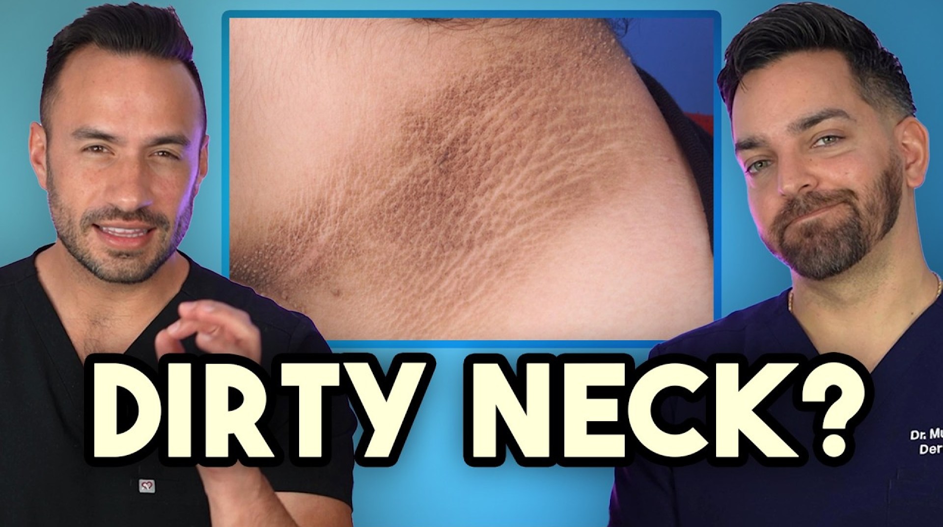 Dark Neck, Armpits, Groin? How to Treat and Prevent Acanthosis Nigricans Dark Neck, Armpits, Groin? How to Treat and Prevent Acanthosis Nigricans