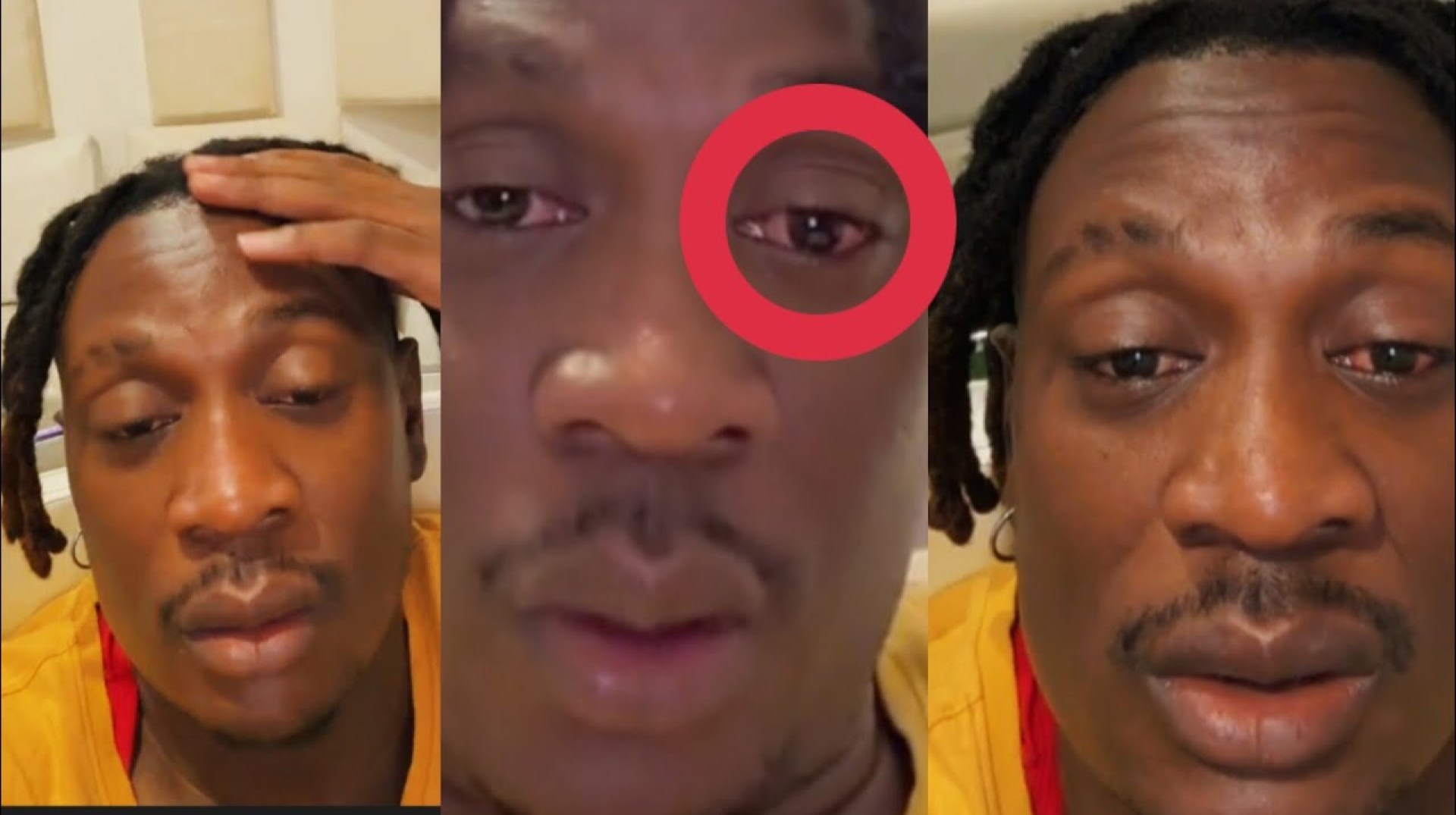 Red Eye Affected Fik fameica So Bad#fikfameica #trending #new #redey#red #eyes #bobiwine #latestnews Red Eye Affected Fik fameica So Bad#fikfameica #trending #new #redey#red #eyes #bobiwine #latestnews