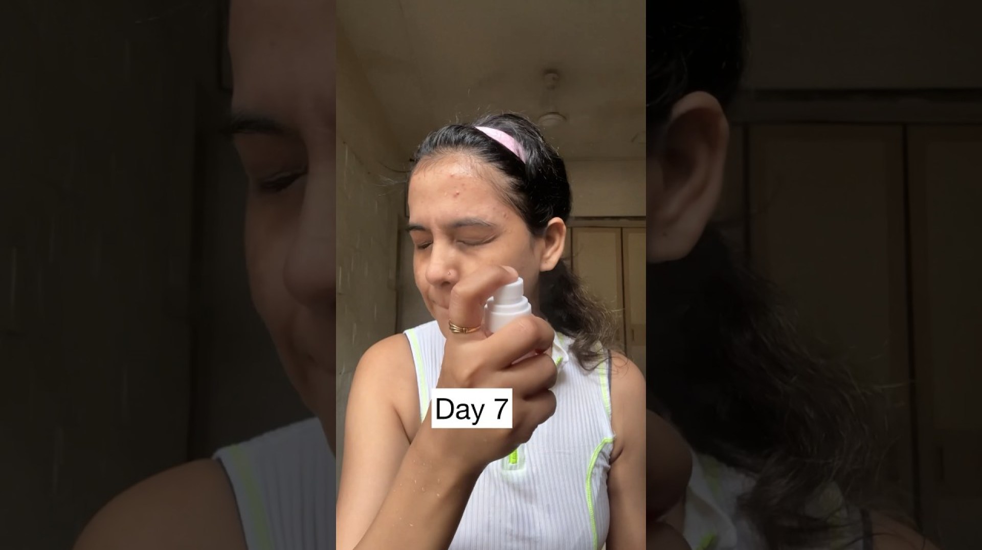 Did Rice Water actually make my skin worse? #challenge #ricewaterchallenge Did Rice Water actually make my skin worse? #challenge #ricewaterchallenge