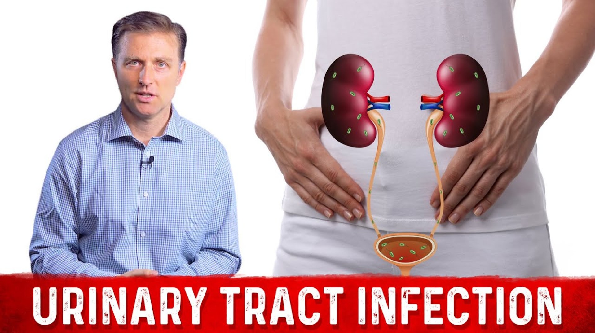 Best Home Remedy for Urinary Tract Infection (UTI) – Dr. Berg Best Home Remedy for Urinary Tract Infection (UTI) – Dr. Berg