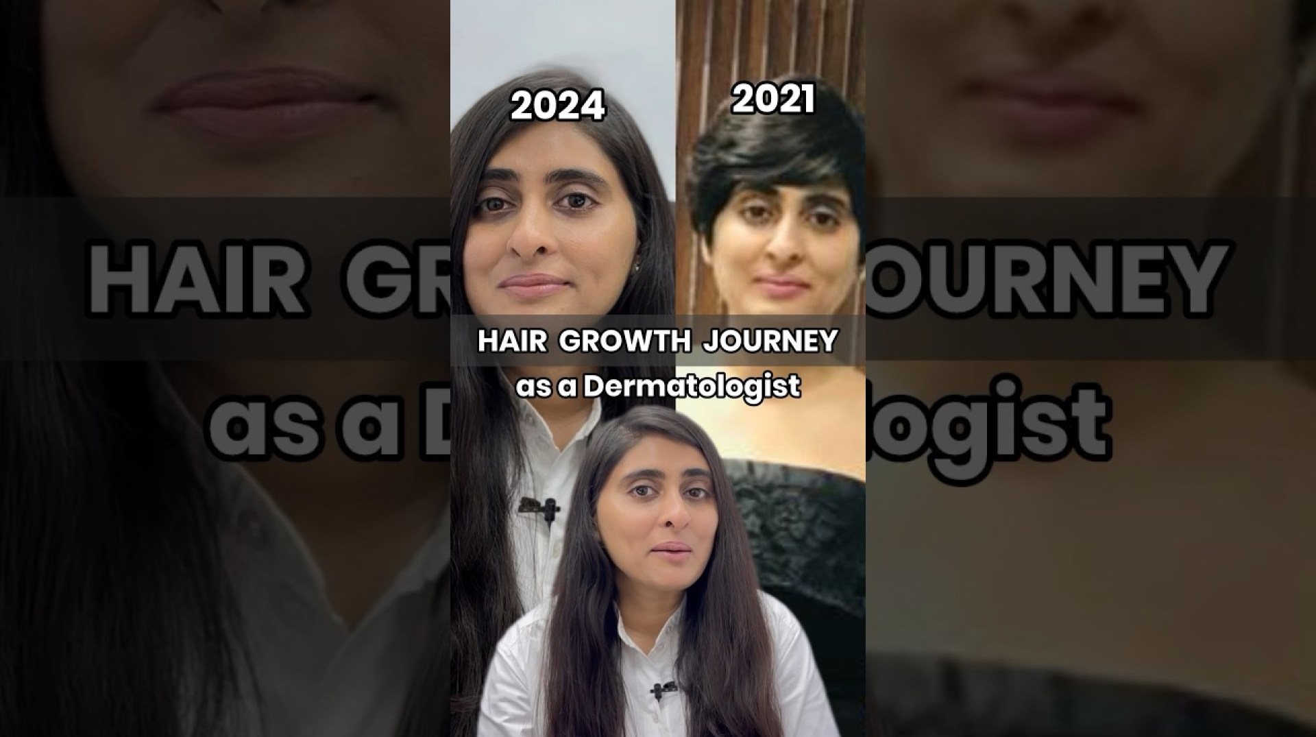 How to grow hair faster | Hair growth before and after | Hair tips for growing long hair How to grow hair faster | Hair growth before and after | Hair tips for growing long hair