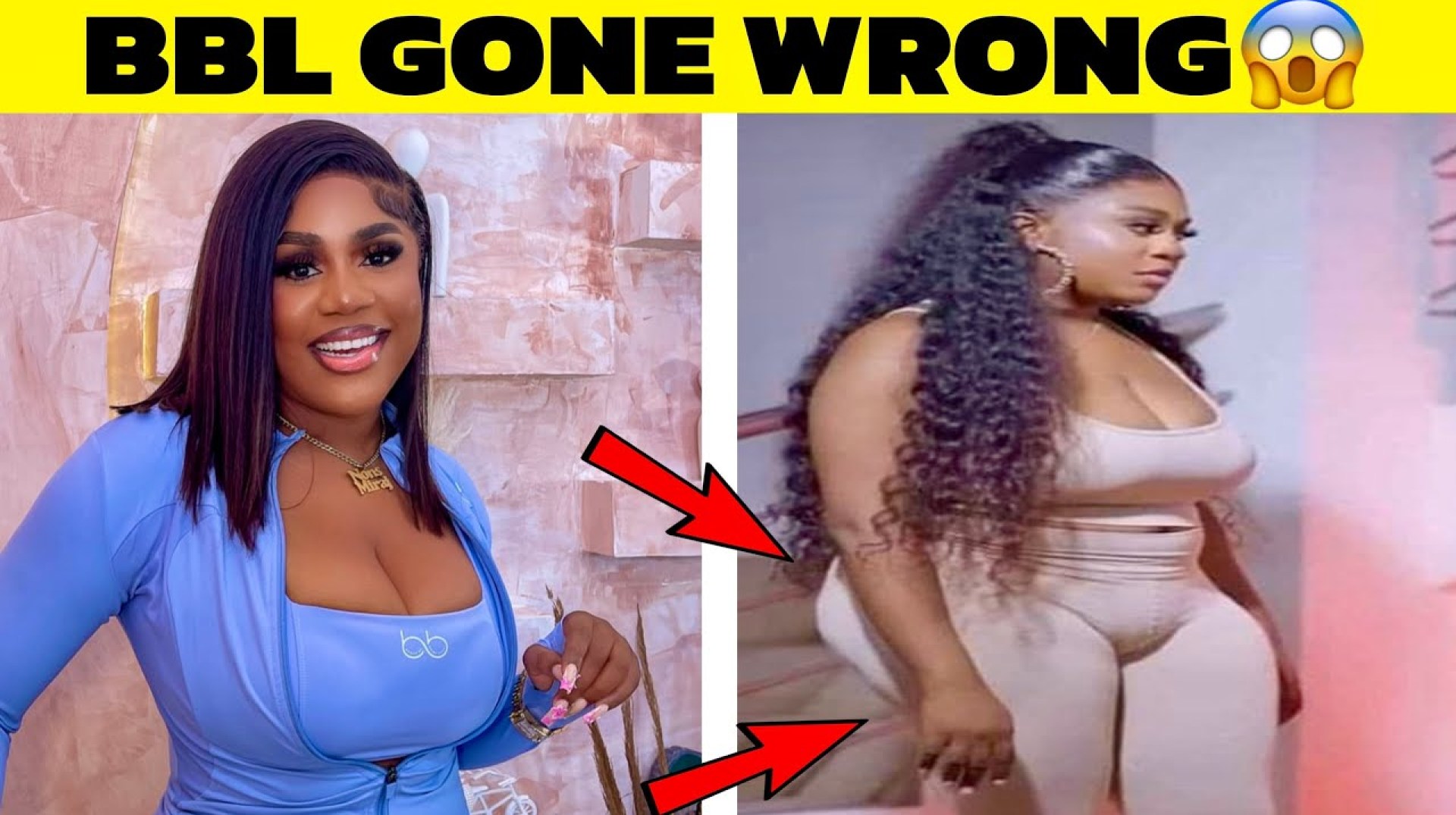 Top Nollywood Actresses Plastic Surgery Gone Wrong! Top Nollywood Actresses Plastic Surgery Gone Wrong!